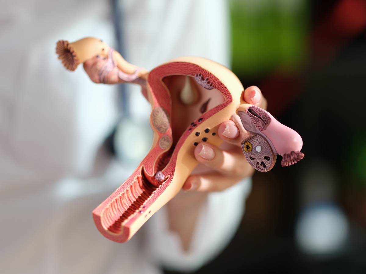 A person holding an anatomical model of a uterus and the ovaries.